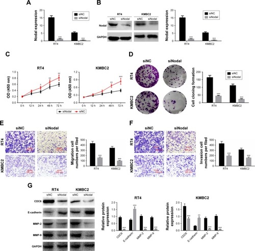 Figure 2 Downregulation of Nodal inhibited cell proliferation, migration, and invasion in bladder cancer cells.