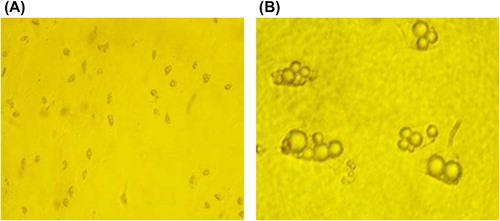 Figure 7. Formation of lipid droplets after adipogenic induction of ASCs. (A) Lipid droplets formed within 2 weeks after adipogenic induction (× 200). (B) Intracellular lipid droplets (× 1000).