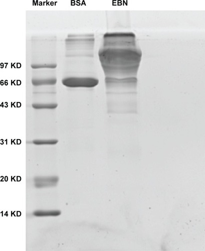 Figure 1 SDS–PAGE analysis of EBNE protein.