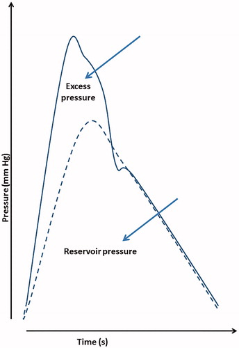 Figure 2. Schematic of aortic pressure wave decomposition into excess pressure and reservoir pressure components.