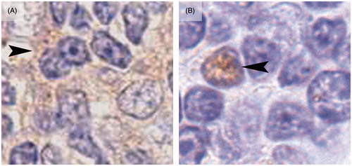 Figure 3. Differences between nuclear and cytoplasmic Ki-67 signal in lymphocytes from male and female mice. (A) Lymphocytes from exposed male mice (4 week exposure) show a cytoplasmic (arrowhead) positive signal (ochre color) to Ki-67, while the nucleus (purple) from these cells were negative for this marker. (B) Lymphocyte from exposed female mice (4 week exposure) shows a positive nuclear staining to Ki-67 (arrowhead) while the cytoplasm was clearly negative for the marker.