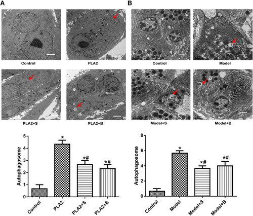 Figure 4 Snake-derived PLI reduced autophagic body formation in PLA 2-treated cells and AP mice model. (A) TEM results of cells; (B) TEM results of pancreatic tissue. Arrows indicate the autophagic bodies. *P<0.05: compared with the control group; #P<0.05: compared with the model group.