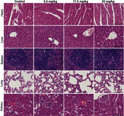 Figure 7 Organ tissues of mice were stained with H&E after 14 d of treatment with PBS or 5.5 mg/kg or 17.5 mg/kg or 55 mg/kg FA-IR780-NP. The scale bars represent 100 μm, n=6 per group.