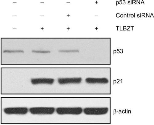 Figure 2 Role of p53 in TLBZT-induced p21 expression.