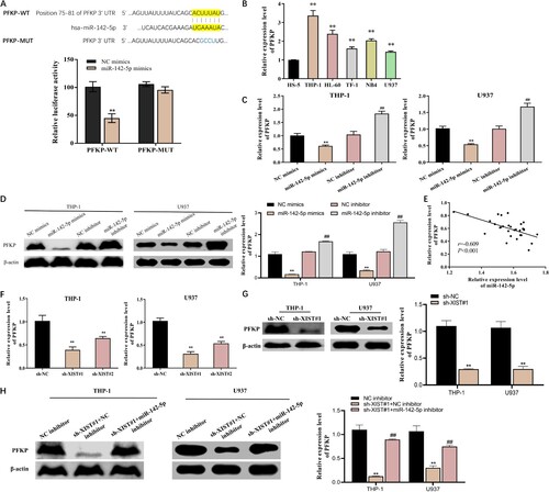 Figure 5. The targeting relationship between miR-142-5p and PFKP in acute myeloid leukemia cells. A, Dual luciferase reporter assay to verify the targeting relationship between miR-142-5p and PFKP, **P < 0.01 vs. NC mimics group; B, qRT-PCR to detect the expression of PFKP in in cell lines (THP-1, HL-60, TF-1, NB4 and U937) of acute myeloid leukemia and human normal bone marrow cells (HS-5) (n = 3), **P < 0.01 vs. HS-5 group; C, qRT-PCR to measure the expression of PFKP mRNA after overexpression or inhibition of miR-142-5p in THP-1 and U937 cells, **P < 0.01 vs. NC mimics group, ##P < 0.01 vs. NC inhibitor group; D, Western blot to determine the protein expression of PFKP after overexpression or inhibition of miR-142-5p in THP-1 and U937 cells; E, Correlation analysis to test the association between miR-142-5p and PFKP (n = 30); F, qRT-PCR to measure the expression of PFKP mRNA after inhibition of lncRNA XIST in THP-1 and U937 cells; G, Western blot to evaluate the expression of PFKP protein after inhibition of lncRNA XIST in THP-1 and U937 cells, **P < 0.01 vs. si-NC group; H, Western blot to detect the PFKP expression in THP-1 and U937 cells in each group, **P < 0.01 vs. NC mimics group, ##P < 0.01 vs. si-XIST#1 + NC inhibitor group. Values were expressed as mean ± standard deviation.