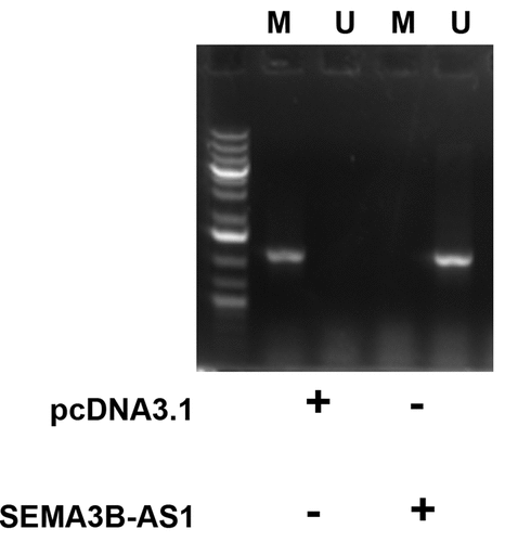 Figure 5. SEMA3B-AS1 increased the methylation of miR-195 promoter U87 cells were transfected with empty pcDNA3.1 vector or EMA3B-AS1 vector, followed by performing MSP to detect the methylated (m) and un-methylated (u) promoter of miR-195 gene.