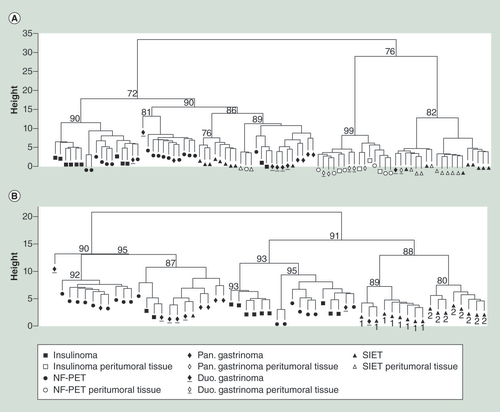Figure 1. Hierarchical clustering of tumoral and peritumoral samples according to DNA methylation patterns. (A) Dendrogram of all tumoral and all peritumoral samples. (B) Dendrogram of all tumoral samples. Values above each cluster correspond to the approximately unbiased value obtained after 10,000 multiscale bootstrap resampling tests. The numbers under the SIETs in the dendrogram presented in the (B) panel correspond to the two groups of SIETs identified according to the cluster analysis presented in the (A) panel (1 or 2 for the SIETs clustering respectively with the SIET peritumoral samples or the other tumors).Pan.: Pancreatic; Duo.: Duodenal; NF-PET: Non-functioning pancreatic endocrine tumor; SIET: Small intestine endocrine tumor.