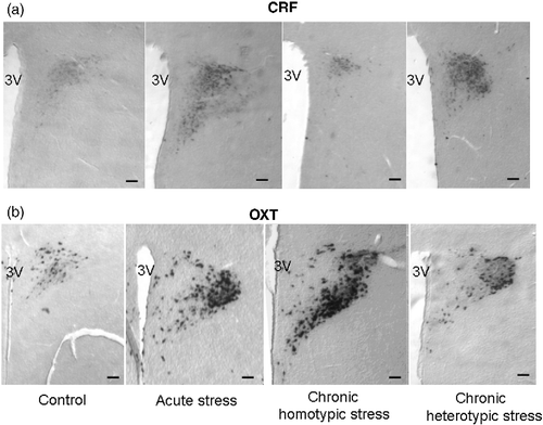 Figure 3.  In situ hybridization autoradiographs for CRF mRNA (a) and OXT mRNA (b) in the PVN in control, acute stress, chronic homotypic stress, and chronic heterotypic stress rats. 3V; 3rd ventricle; scale bar 200 μm.