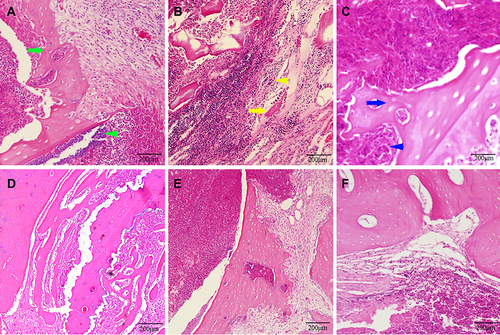 Figure 5 Photomicrographs of the longitudinal section of the tibia in the control group (n=10) (A–C) showing cortical bone destruction, sequestrum formation (green arrow), severe inflammation with intramedullary abscess (green arrowhead), remodeled bone (yellow arrow), fibrosis (yellow arrowhead), periosteal new bone formation (blue arrow), and sequestrum surrounded by proliferated foamy histiocytes (blue arrowhead) with H&E. The NBD group (n=11) (D) and cefazolin group (n=12) (E) showed mild calcification and destruction of cortical bone, and new bone was found in the medulla, and in the PBS group (n=8) (F), there were prompt normal bone(H&E), respectively. All samples of animals were examined.