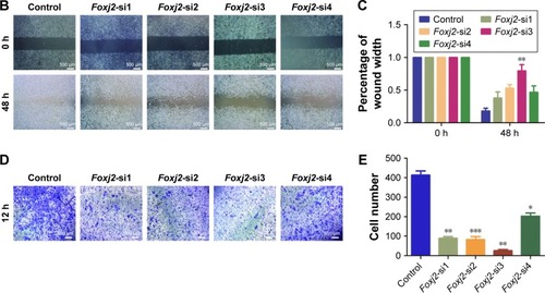 Figure 5 Knockdown of Foxj2 decreases the migration of CNE-2 cells.