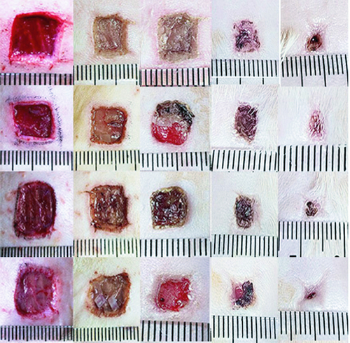 Figure 4. The effect of human umbilical cord mesenchymal stem cells combined with porcine small intestinal submucosa on wound healing.