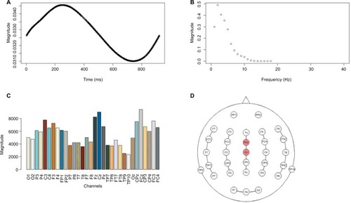 Figure 2 Neural response channel–frequency–time domain after Parafac calculation in healthy pain-free participants (n=10).