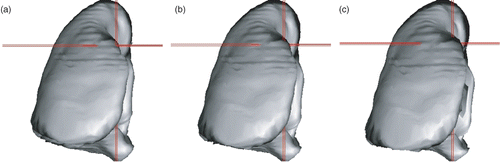 Figure 7. Three simulated CTs for one patient (patient A in our tests), representing two intermediate points (a and b) and the end-inspiration (c). The red crosses are on the same 3D points in each volume. [Color version available online.]