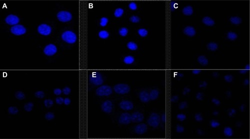 Figure 7 Effects of Ost, Ost/NSC-NPs, and Ost/LDL-NSC-NPs on HepG2 apoptosis.Notes: HepG2 cells were treated with (A) negative control, (B) NSC-NPs, (C) LDL-NSC-NPs, (D) 100 μg·mL−1 Ost, (E) 100 μg·mL−1 Ost/NSC-NPs, and (F) 100 μg·mL−1 Ost/LDL-NSC-NPs, and then stained with Hoechst 33258 (blue).Abbreviations: LDL, low-density lipoprotein; NPs, nanoparticles; NSC, N-succinyl-chitosan; Ost, osthole.