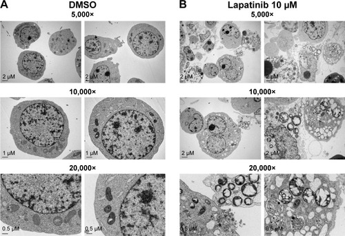 Figure 4 The induction of massive vacuoles inside cells by lapatinib in U937 cells.