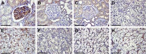 Figure 1 Immunohistochemical detection of vascular B7-H3 and Tie-2 expression in ccRCC (×400). (A) Vascular distribution (CD34 labeling) in adjacent normal renal tissues showing that renal corpuscle have abundant blood vessels and that blood vessels are scattered in the renal parenchyma. (B) B7-H3 expression was observed in the renal tubular epithelia of adjacent normal tissues, but no expression was detected in glomerular blood vessels and renal parenchymal vessels. (C) Tie-2 expression was found in the renal tubular epithelium and glomerular vascular epithelium of adjacent normal tissues. (D) Low vascular B7-H3 expression in ccRCC tissues. (E) High vascular B7-H3 expression in ccRCC tissues. (F) Low vascular Tie-2 expression in ccRCC tissues. (G) High vascular Tie-2 expression in ccRCC tissues. (H) CD34-labeled MVD in ccRCC tissues. Scale bar 40 µm.