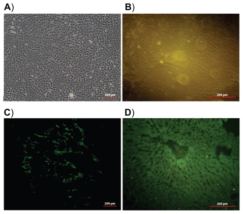 Figure 6 Light image of liver tissue section (A). Fluorescence images of liver tissue sections 24 hours after intravenous injection of: saline (B), pegylated nanoparticles (C), and nonpegylated nanoparticles (D).