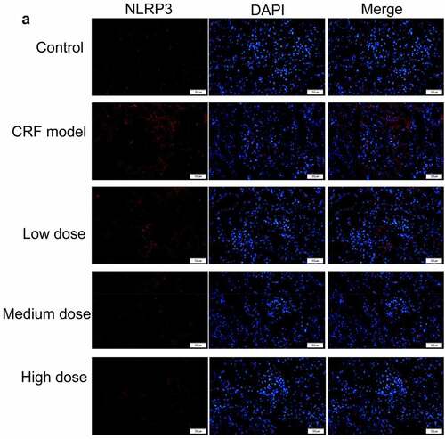 Figure 4. Regulatory effects of Quercetin on CRF genes and proteins. A-D, Expression of NLRP3, caspase1, AQP1, and AQP2 was detected by immunofluorescence. E, Statistical results of the average fluorescence intensity. F-G, Expression of p-PI3K, p-AKT, NLRP3, Caspase1, AQP1, and AQP2 by western blot. H, Grayscale statistical results of western blot. #, p < 0.05. ##, p < 0.01. Scale bar: 50 μm