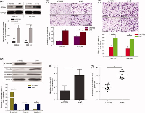 Figure 5. Knockdown of TGFB2 partially phenocopied the inhibitory effects of miR-324-5p overexpression on GBC cell metastatic behaviours. (A) Relative protein expression of TGFB2 in TGFB2 small interfering RNA (si-TGFB2) or control siRNA (si-NC) treated GBC-SD and SGC-996 cells was determined by Western blot assay. (B) Transwell migration assay was used to evaluate the cell migration capacity in GBC cells after treatment with si-TGFB2 or si-NC. (C) Transwell invasion assay showed that GBC-SD and SGC-996 cells transfected with the si-TGFB2 had decreased invasive capacities compared to the si-NC groups. (D) si-TGFB2 promoted the expression of E-cadherin and inhibited the expression of N-cadherin and Vimentin in SGC-996 cells. (E) The number of mice with liver metastasis was calculated and compared at the 42nd day following intra-splenic injection. (F) The number of metastatic foci per liver in nude mice was calculated and compared. The mean ± SD of triplicate experiments were plotted, *p < .05.