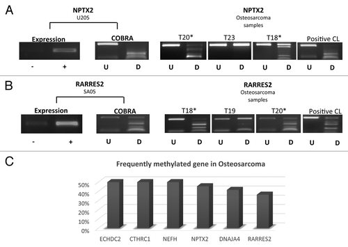 Figure 5. Expression and methylation analysis for NPTX2 and RARRES2 in osteosarcoma cell lines and primary tumors. (A) NPTX2 (B) RARRES2 expression and methylation (COBRA) results in osteosarcoma cell line and tumors. (C) Frequently methylated genes in osteosarcoma with the methylation frequency for each gene. -, gene expression before 5-azaDC treatment; +, gene expression after 5-azaDC; U, undigested samples; D, BstU1 digested samples; *, methylated samples; CL, positive control.