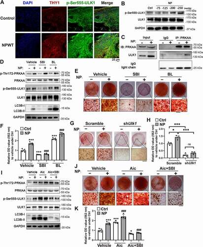 Figure 6. ULK1 phosphorylation by AMPK is required for NP-induced autophagy and osteoblast differentiation. (A) Immunofluorescence staining (frozen section) for p-Ser555-ULK1, THY1 and DAPI in craniums from the control and NPWT rats; scale bar: 25 µm. (B) Western blot analysis of ULK1 activation in MSCs under control and different pressures for 48 h. (C) MSCs were treated under control and NP conditions (−200 mmHg treated for 48 h). Immunoprecipitation (IP) was performed with PRKAA antibody or pre-immune IgG. Immunoblotting (IB) was carried out to detect PRKAA and ULK1. (D) Western blot analysis of AMPK-ULK1/autophagic activation in MSCs treated with ULK1 inhibitor SBI-0206965 (SBI, 1 µM) or agonist BL-918 (BL, 15 µM) under control and NP treatment. (E) Alizarin Red staining of MSCs after osteoblast differentiation for 18 days with SBI or BL under control and NP treatment; scale bar: 2 mm (squares: magnification zones, scale bar: 250 µm). (F) Quantitative analysis of the E-panel Alizarin Red staining (n = 4 in each). (G) Alizarin Red staining of MSCs after osteoblast differentiation for 18 days infected with scramble or shUlk1 lentivirus under control and NP treatment; scale bar: 2 mm (squares: magnification zones, scale bar: 250 µm). (H) Quantitative analysis of the G-panel Alizarin Red staining (n = 3 in each). (I) Western blot analysis of AMPK-ULK1-autophagy activation in MSCs with an PRKAA agonist AICAR (Aic, 15 µM) or/and ULK1 inhibitor SBI-0206965 (SBI, 1 µM) under control and NP treatment. (J) Alizarin Red staining of MSCs after osteoblast differentiation for 18 days with Aic or/and SBI under control and NP conditions; scale bar: 2 mm (squares: magnification zones, scale bar: 250 µm). (K) Quantitative analysis of the J-panel Alizarin Red staining (n = 4 in each). Data were presented as mean ± SEM. *P < 0.05 versus control; **P < 0.01 versus control; ***P < 0.001; ### P < 0.001 versus NP group tested by one-way ANOVA followed by Bonferroni’s post hoc test.