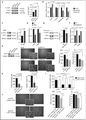 Figure 5. For figure legend, see page 2133. Figure 5 (See previous page). The transcription co-activator YAP1 is a key player in the autophagy-dependent proliferation and invasion of TN BC cells. (A) Western blots showing phosphorylated-YAP1 (P-YAP1), YAP1, and AP2A1 proteins in stable cell lines following 3D culture. AP2A1 is used as internal control for protein loading. The bar graph (right panel) shows the corresponding quantification of P-YAP1/YAP1 protein level ratios. (B) mRNA levels of YAP1-target genes were monitored by RT-qPCR following 3D culture. GAPDH is used as an internal control for total mRNA expression. (C) Western blots (left) and corresponding quantification (bar graph, right) showing phosphorylated-YAP1 (P-YAP1), YAP1 and AP2A1 proteins in MDA231 cells cultured during 3 d in 3D and then either untreated (-) or treated with 3-methyladenine (3-MA; 20 mM) for 3 h. (D) mRNA levels of YAP1-target genes were monitored by RT-qPCR following 3-MA treatment. GAPDH is used as an internal control for total mRNA expression. (E) Western blots (left) and corresponding quantification (bar graph, right) showing phosphorylated-YAP1 (P-YAP1), YAP1 and AP2A1 proteins in MDA231 cells cultured during 3 d in 3D and then either untreated (-) or treated with rapamycin (2 μM) for 3 h. (F) mRNA levels of YAP1-target genes were monitored by RT-qPCR following rapamycin treatment. GAPDH is used as an internal control for total mRNA expression. (G) Left, western blots showing YAP1 protein levels in MDA231 cells after transfection with control- (siCtrl) or YAP1-targeted (siYAP1) siRNA. AP2A1 is used as an internal control for protein loading. Middle, representative bright field images from Control- or YAP1-depleted cells cultured in 3D, as indicated. Scale bars = 100 μm (low magnification) and 50 μm (high magnification). Right, the bar graphs represent the total area covered by the stellate structures per field (left panel) and the area per clone (right panel). Data are shown as means +/− sem (N = 3 independent experiments). p-values are based on the Student t test. (H) Invasion assay using a BioCoatTM MatrigelTM Invasion Chamber from MDA231 cells transiently transfected with control- (siCtrl) or YAP1-targeted (siYAP1) siRNA. for 72 h prior to the assay. Left histogram: Numbers of invading cells, which passed through a Transwell over 6 h of incubation. Right panel: Percentage of cells, relative to siCtrl (100%), which passed through a Transwell over 6 h of incubation. Data are shown as means +/− sem (N = 3 independent experiments). p-values are based on the Student t test. (I) Invasion assay using a BioCoatTM MatrigelTM Invasion Chamber from autophagy-deficient MDA231 cells (36 h of transfection with siATG7 or siATG5, as indicated), transfected again (36 h) with an empty vector or a vector expressing YAP1-S127A, a nonphosphorylable mutant form of YAP1. Numbers of invading cells, which passed through a Transwell over 6 h of incubation, are shown. Data are shown as means +/− sem (N = 3 independent experiments). p-values are based on the Student t test. (J) Results are from autophagy-proficient (shCtrl) or autophagy-deficient (shATG5) MDA231 cells, transfected with an empty vector or a vector expressing YAP1-S127A, after 3 d of 3D culture. Representative bright field images from ATG5-depleted cells expressing or not YAP1-S127A, as indicated. Scale bars = 100 μm (low magnification) and 50 μm (high magnification). Bar graphs represent the total area covered by the stellate structures per field (left panel) and the area per clone (right panel). Data are shown as means +/− sem (N = 5 independent experiments). P-values are based on the Student t test.