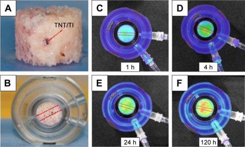 Figure 11 Ex vivo study of transport of drug in bone released from TNTs wire implant.Notes: (A) Photo of trabecular bone with embedded TNTs/Ti wire implant loaded with drug at the center of the bone core (side view). (B) Trabecular bone core with TNTs/Ti wire inside the bone chamber connected to perfusion pump that provides culture media to keep bone cells alive. Bioluminescence images of bone with inserted drug-releasing implant (based on a Ti wire with TNTs on the surface) for local drug delivery: distribution of released model drug (rhodamine B) taken at (C) 1, (D) 4, (E) 24, and (F) 120 h using the Xenogen IVIS® 100 (Caliper Life Sciences, Inc, Hopkinton, MA) in vivo imaging system. Adapted with permission of Dove Medical Press, from Characterization of drug-release kinetics in trabecular bone from titania nanotube implants, Aw MS, Khalid KA, Gulati K, et al. 2012;7:4883–4892; permission conveyed through Copyright Clearance Center, Inc.Citation97Abbreviations: h, hours; TNT, TiO2 nanotube.