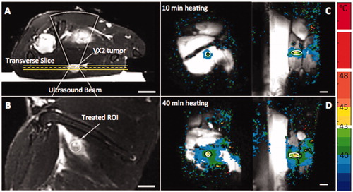 Figure 2. MR-HIFU mild hyperthermia in rabbit Vx2 tumors. Treatment planning images along (A) and across (B) the ultrasound beam (cone shape), with tumor and targeted location indicated by white arrows. MR temperature maps confirm adequate hyperthermia in both the 10 min (C) and 40 min (D) heating groups. White circle indicates the treated ROI, and black contour in (C) and (D) is the 42 °C isotherm. Bar = 2 cm.