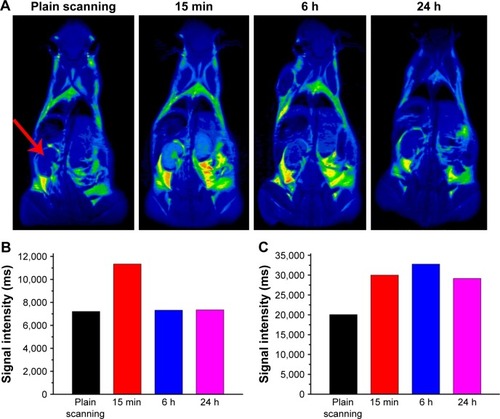 Figure 13 (A) T1-weighted in vivo magnetic resonance imaging (MRI) images of mice post-injection of the Fe3O4@mSiO2/PDDA/BSA-Gd2O3 nanocomplex at different time points (0, 15 min, 6 h, and 24 h). The signal intensities in the kidneys (B) and bladder (C) at different time points after intravenous injection of the Fe3O4@mSiO2/PDDA/BSA-Gd2O3 nanocomplex. The red arrow indicates the kidney.
