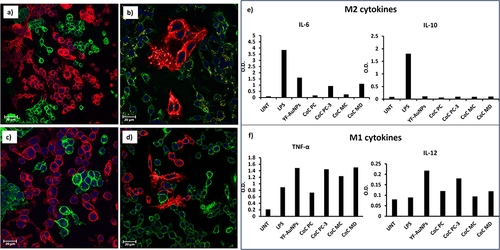 Figure 16 Confocal microscopy images of (a) co-culture of PC-3 cell lines (red) and naive RAW 264.7 macrophage cell line (green); (b) co-culture of PC-3 cell lines (red) and YF-AuNPs pre-treated RAW 264.7 macrophage cell line (green); (c) co-culture of MDAMB 231 cell lines (red) and naive RAW 264.7 macrophage cell line (green); and (d) co-culture of MDAMB 231 cell lines (red) and YF-AuNPs pre-treated RAW 264.7 macrophage cell line (green) demonstrated an ability of YF-AuNPs activated RAW 264.7 macrophage cell line to suppress the growth of prostate and breast tumor cells. Immunomodulatory activity of YF-AuNPs showed (e) reduced levels of pro-tumor cytokines (IL-6 and IL-10) and (f) elevated levels of anti-tumor cytokines (TNF-α and IL-12) indicative of a polarization shift in the macrophage phenotype from pro-tumor M2 to anti-tumor M1.