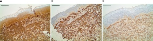 Figure 2 Fibrillin 1 dermal histology.