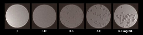 Figure 4 MR images of SPIO/Ca-ALG microspheres (~500 µm) with varied content of SPIO NPs.Abbreviations: MR, magnetic resonance; SPIO, superparamagnetic iron oxides; Ca-ALG, calcium alginate; NPs, nanoparticles.