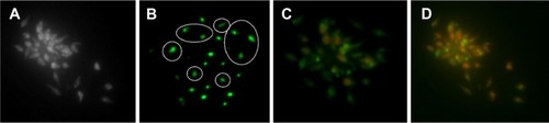 Figure 9 Apoptosis and necrosis of Leishmania cells after exposure to ZnCuO3 particles for 1 and 3 hours.Notes: (A) Bright field image; (B) cell exposure to ZnCuO3 particles at 1 hour; the encircled regions show the formation of apoptotic bodies within the cells with some showing early apoptosis (light green); (C) apoptotic and necrotic cells at 1 hour exposure to ZnCuO3 particles, with 50% of the cells showing necrosis and the remaining show early and late apoptosis; and (D) apoptotic and necrotic cells at 3 hours exposure to ZnCuO3 particles. Almost 90% of the cells show necrosis and the remaining show early and late apoptosis.