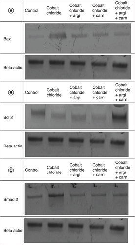 Figure 4. (A–C) Representative immunoblots (Western blot analysis) of renal Bax, Bcl 2, and Smad-2 in control and different treated groups.