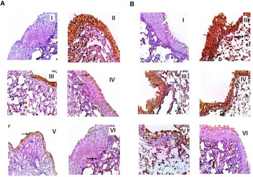 Figure 11 Microscopy of immunolabeling against TNF-α (A) and VEGF (B) in conjunctiva in allergic conjunctivitis-model rabbits after topical application of different gel formulations: normal control (I), histamine (II), post-treated MZL gel (III), post-treated MZL-SLNs gel (IV), pre-treated MZL gel (V), and pre-treated MZL-SLNs gel (VI).