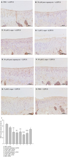 Figure 8 Intra-articular injection of L-rapa at 5 μM and 50 μM with LIPUS or sLIPUS significantly and largely reduced MMP-13 stained by IHC in the cartilage of knee in spontaneous OA Dunkin-Hartley guinea pigs (I). L-rapa at 50 μM and 5 μM in combination with LIPUS exhibited the strongest inhibition on MMP-13 production in the cartilage by around 55.2% and 47.3%, respectively (Groups F and G). The intensity of IHC was measured by Image-Pro plus 5.1 and the IHC images of MMP-13 were showed at 12.5 magnificence (A-H) (**P<0.01, ***P<0.001; by one-way ANOVA, Group A: n=5, Groups B~G: n=8, Group H: n=3).