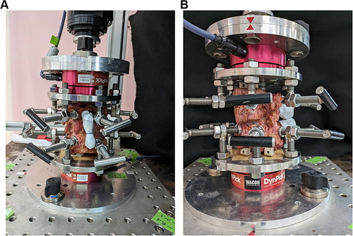 Figure 1 A test model replicating a kissing spine (A) Posterior view (B) Lateral view.