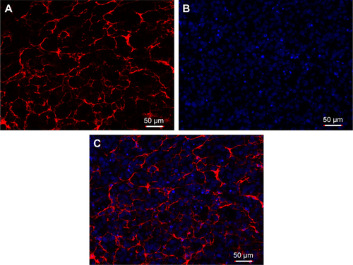 Figure S1 Histopathological study. The stromal response in this orthotopic nude mouse model of pancreatic ductal adenocarcinoma was detected by immunofluorescence of collagen type I, which is a major component of the extracellular matrix. A: Red indicates detected collagen type I; B: blue indicates DAPI stained cell nuclei; and C: the merged image of A and B. Original magnification 200×.Abbreviation: DAPI, 4,6-diamidino-2-phenylindole.