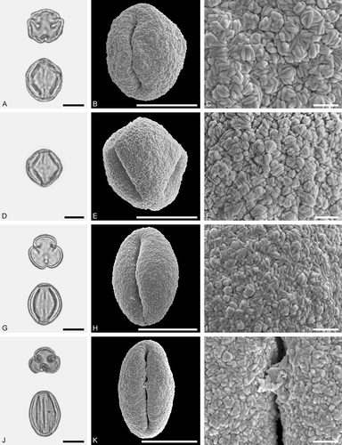 Figure 8. LM (A, D, G, J) and SEM (B, C, E, F, H, I, K, L) micrographs of dispersed fossil Fagaceae pollen. A–F. Quercus sp. 3 (Quercus Group Ilex), close-ups of central mesocolpium. G–L. Quercus sp. 4 (Quercus Group Ilex), close-ups of mesocolpium (I) and area around colpus (L). Scale bars – 10 µm (A, B, D, E, G, H, J, K), 1 µm (C, F, I, L).