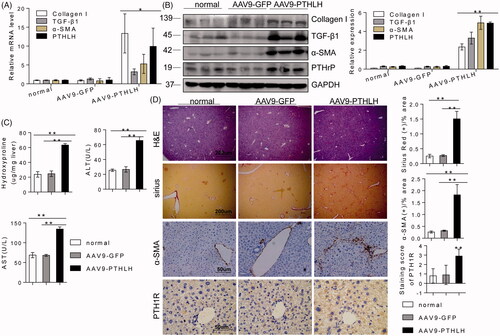 Figure 4. AAV9-PTHLH in the liver induced hepatic fibrosis. Mice were divided into three groups, normal mice not subjected to any treatment, and an AAV9-GFP and AAV9-PTHLH group that were treated with AAV9-GFP or AAV9-PTHLH, respectively, through the tail vein at doses of 1 × 1011 plaque-forming units in 0.1 ml of saline, and these mice hosted for 6 months. (A, B) Western blot analysis and quantitative RT-PCR showing the expression levels of collagen I, TGF-β1, α-SMA and PTHLH in response to AAV9-PTHLH injection into mice. (C) The liver hydroxyproline and serum ALT and AST levels in different group. (D) Representative microphotograph of H&E and Sirius Red-stained paraffin-embedded sections of liver tissues and immunohistochemistry staining of α-SMA and PTH1R. Sirius Red, PTH1R and α-SMA staining scores were determined by morphometric analysis. The relative mRNA levels are expressed as fold induction over the level in the normal group after normalization to GAPDH, and the relative protein levels were also normalized to the GAPDH level. The data are the mean ± SD fold values over the control. *p < .05, **p < .01.