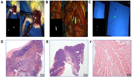 Figure 3 Fluorescence imaging of ICG-HSA NPs guiding SLN resection surgery and slice examination. (A) Visible light, fluorescence signals, and their real-time overlay pictures in the ICG-HSA NPs -guided SLN resection. (B) Visible light, fluorescence signals, and their real-time overlay during right iliac fossa lymphadenectomy guided by ICG-HSA NPs. (C) From top to bottom are the visible light, fluorescence signals, and their real-time overlay of the left thigh muscle, SLN, and second-tier LN. (D–F) H&E staining images of the SLN, second-tier LN, and left thigh muscle, respectively.