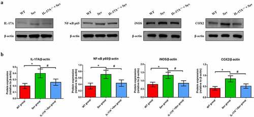 Figure 7. IL-17A deletion ameliorates activation of repeated sevoflurane exposure-induced NF-κB signaling pathway in neonatal mice. (a) Representative western blot of IL-17A, NF-κB p65, iNOS and COX-2. (b) Representative histogram of the relative expression of IL-17A, NF-κB p65, iNOS and COX-2. Data are expressed as mean ± SD (n = 10 for each group). Compared with the WT group, *P < 0.05; compared with the Sev group, #P < 0.05.