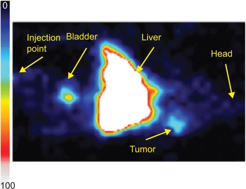 Figure 3 Scintigraphic image of hybrid radiolabeled Fe3O4-1-PNP-hEGFR-99mTc in an A431 tumor-bearing SCID mouse model. The tumor site is clearly visible, indicating accumulation of the nanosystems.Abbreviations: hEGFR, human epidermal growth factor receptor; PNP, polymeric nanoparticles; SCID, severe combined immunodeficiency.