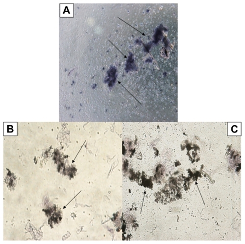Figure 4 Microscopic views of the effects of silver nanoparticles (Ag-NPs) on metabolic activity of Leishmania parasites under ultraviolet light: (A) parasites in the control group (not exposed to Ag-NPs), (B) the cytopathic effects of Ag-NPs at 150 μg/mL, and (C) the cytopathic effects of Ag-NPs at 200 μg/mL. Arrows in (A) indicate the formation of formazan crystals and in (B) and (C) indicate the clusters of Ag-NPs (magnification 40×).