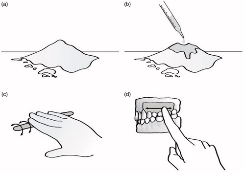 Figure 2. Periodontal dressing powder (a) is mixed with eugenol (b), rolled into a “sausage shape” (c), and applied to a patient’s gums to assist with the healing process by protecting the wound from physical trauma and providing stability at the surgical site (d).