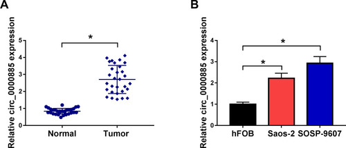 Figure 1 Circ_0000885 had high expression in OS. (A) The expression of circ_0000885 was examined by qRT-PCR in OS tumor tissues (Tumor) and matched normal tissues (Normal). (B) QRT-PCR was used to detect the circ_0000885 expression in OS cells (Saos-2 and SOSP-9607) and hFOB cells. *P < 0.05.Abbreviations: OS, osteosarcoma; qRT-PCR, quantitative real-time polymerase chain reaction.