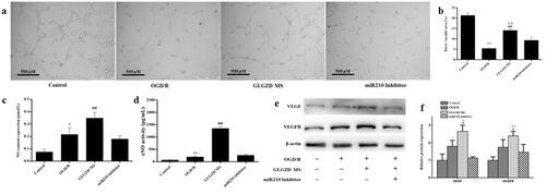 Figure 6. miR210 inhibitor reverses the GLGZD-mediated promotion of angiogenesis on HUVECs. The impact of miR210 inhibitor and GLGZD on tube formation (a) (scale bar = 500 μm), NO content and activity of eNOS (b), relative protein expression of VEGF and VEGFR2 (c, d) in HUVECs after OGD/R for each group. Data are presented as mean ± SD. *p < 0.05, **p < 0.01 vs. control, #p < 0.05, ##p < 0.01 vs. OGD/R, Δp < 0.05, ΔΔp < 0.01 vs. miR210 inhibitor.