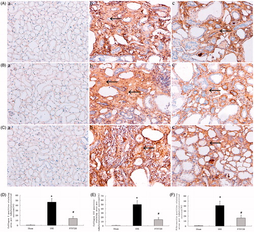 Figure 7. Effects of FTY720 on protein expression of collagens I, III and fibronectin. Representative tubulointerstitial immunostaining of collagens I (A), III (B) and fibronectin (C) are shown for the sham (a), untreated SNX (b) and FTY720-treated SNX groups (c). Original magnification: ×200. the positive-staining areas of collagens I, III and fibronectin are larger in the SNX rats than in the sham; FTY720 administration significantly reduced these abnormalities (D, E, F). Data are presented as the mean ± SD, n = 8, *p < 0.01 versus sham, #p < 0.01 versus SNX.