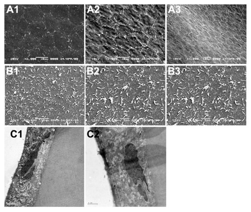 Figure 5 (A1–C2) Scanning electron microscopy of corneal endothelium and anterior lens capsule, and transmission electron microscopy of corneal endothelial cells on day 28 after operation. (A1) Cornea endothelial cell: smooth surface, in regular hexagonal shape, healthy tight cell junction with microvilli, 200×; (A2) MMC membrane implanted, day 28, no abnormality on cornea endothelial surface, 200×; (A3) 5-FU membrane implanted, day 28, no abnormality on cornea endothelial surface, 100×; (B1) anterior lens capsule from control group, microvilli were observed, 200×; (B2) MMC membrane implanted, day 28, no abnormality on anterior lens capsule surface 200×; (B3) 5-FU membrane implanted, day 28, no abnormality observed on the surface of anterior lens capsule, 200×; (C1) MMC membrane implanted, day 28, microvilli observed on cornea endothelial surface, containing large amount of mitochondria and rough endoplasmic reticulum, no abnormality found, 200×; (C2) 5-FU membrane implanted, day 28, microvilli observed on cornea endothelial surface, containing large amount of mitochondria and rough endoplasmic reticulum, no abnormality found, 200×.