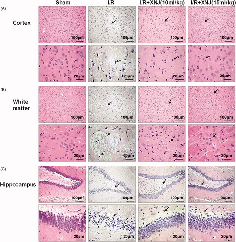 Figure 2. XNJ prevented morphologic injury in cerebral I/R injury rats. (A) Cerebral cortex of I/R brain after 24 h of reperfusion viewed H&E-staining. (B) White matter of I/R brain after 24 h of reperfusion viewed H&E-staining. (C) Hippocampus I/R brain after 24 h of reperfusion viewed H&E-staining. (scale bar = 50 or 20 µm). The black arrow represents the pyknotic nucleus. n = 3 in each group.